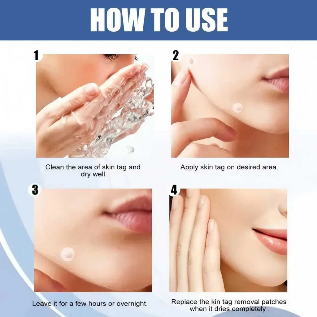 Star Pimple Patches